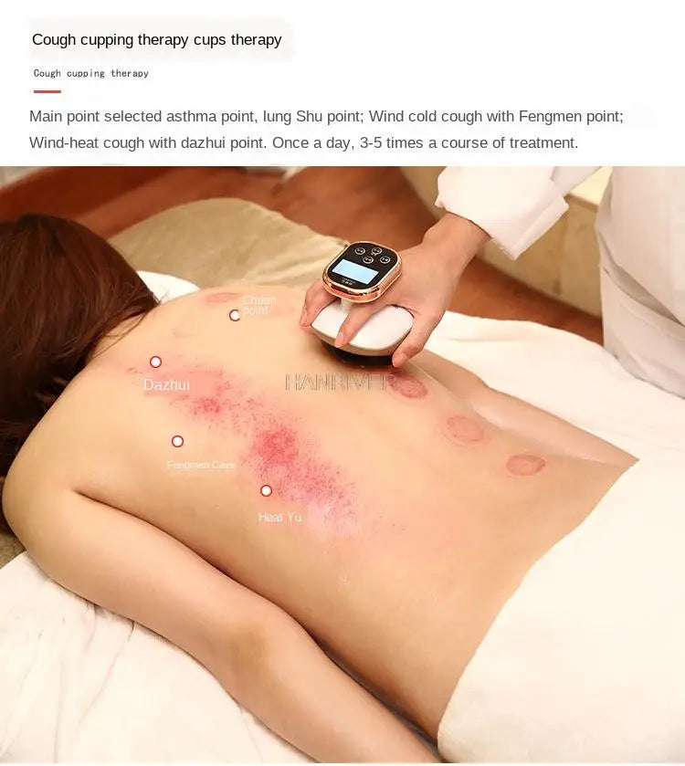 Cupping Massager LCD Display Vacuum Suction Cups EMS Ventosas Anti Cellulite Magnet Therapy Guasha Scraping Fat Burner Slimming